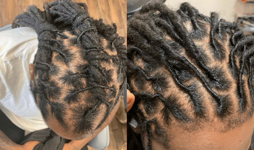DREADLOCKS